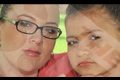Una madre británica infiltra botox a su hija de ocho años para eliminar las arrugas