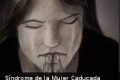 Síndrome de la Mujer Caducada