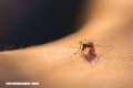 Ya son 16 los casos confirmados de Zika en Florida y gobernador pide más kits de pruebas