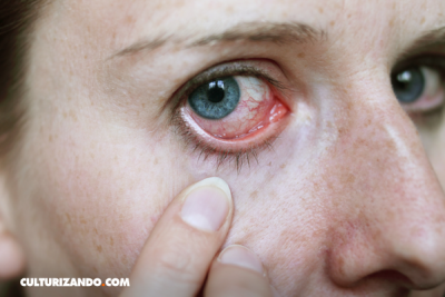 ¿El rojo de nuestros ojos es por el cloro de la piscina? ¡No!