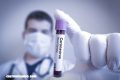 Argentina registra primer muerto por coronavirus en América Latina