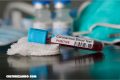 Suman 10 millones de casos de coronavirus en el mundo